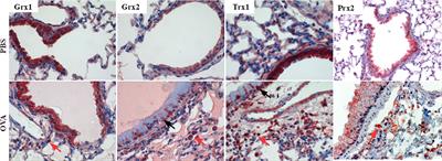 Glutaredoxin 2 Reduces Asthma-Like Acute Airway Inflammation in Mice